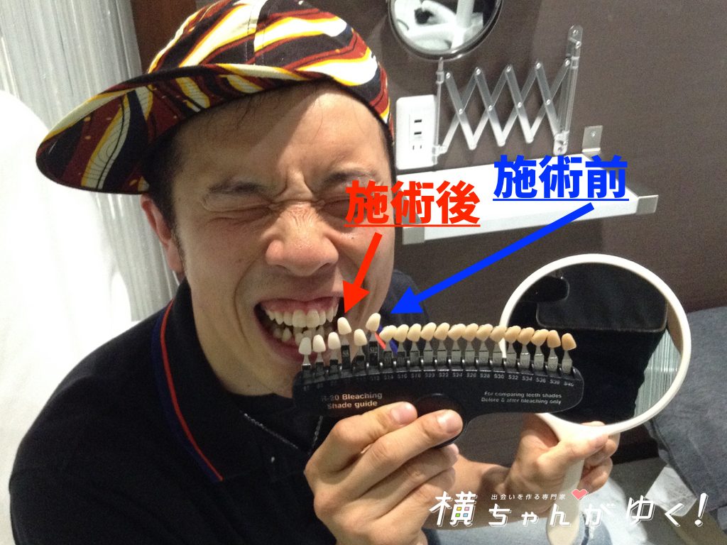 比較2
